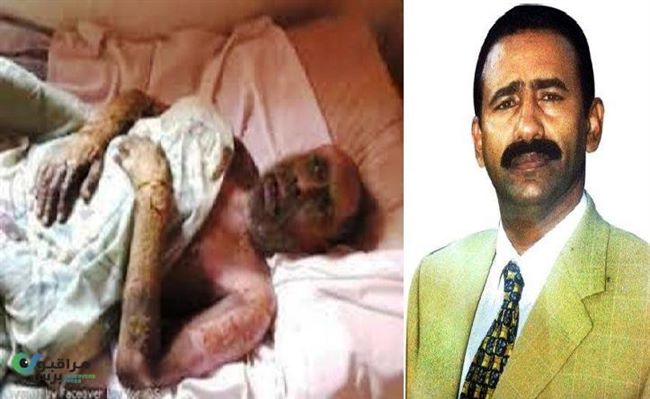 مرافق صالح طوال 33 عاما يروي مشاهداته له لحظة اصابته بتفجير النهدين