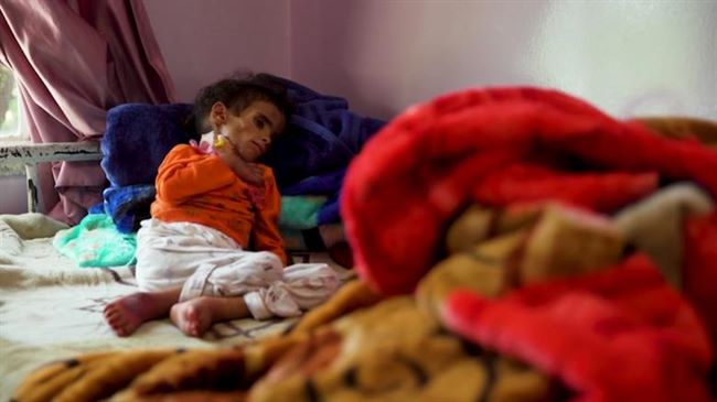 CNN تكشف كيفية تلاعب الحوثيين بالمساعدات واليمن على شفا المجاعة(فيديو)