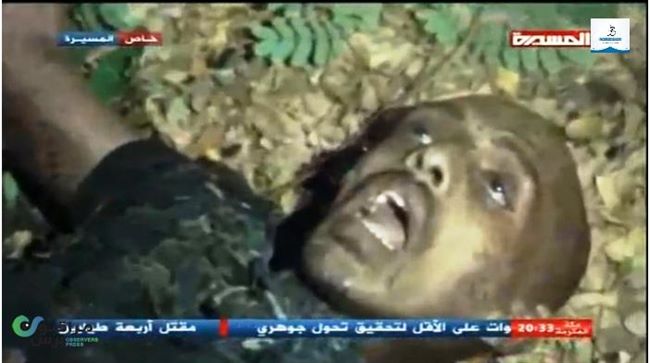فيديو وصور واضحة لأشلاء الانتحاري الذي استهدف الحوثيين بالحديدة(شاهد)